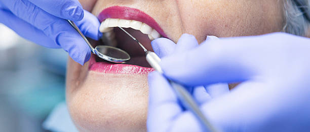 Best Emergency Root Canal Treatment in San Martin, CA